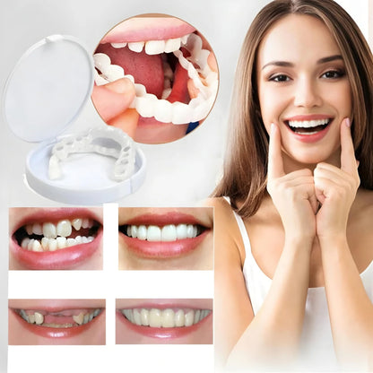 2Pcs/Set Comfort Fit White Teeth Cover Top Veneer Kit