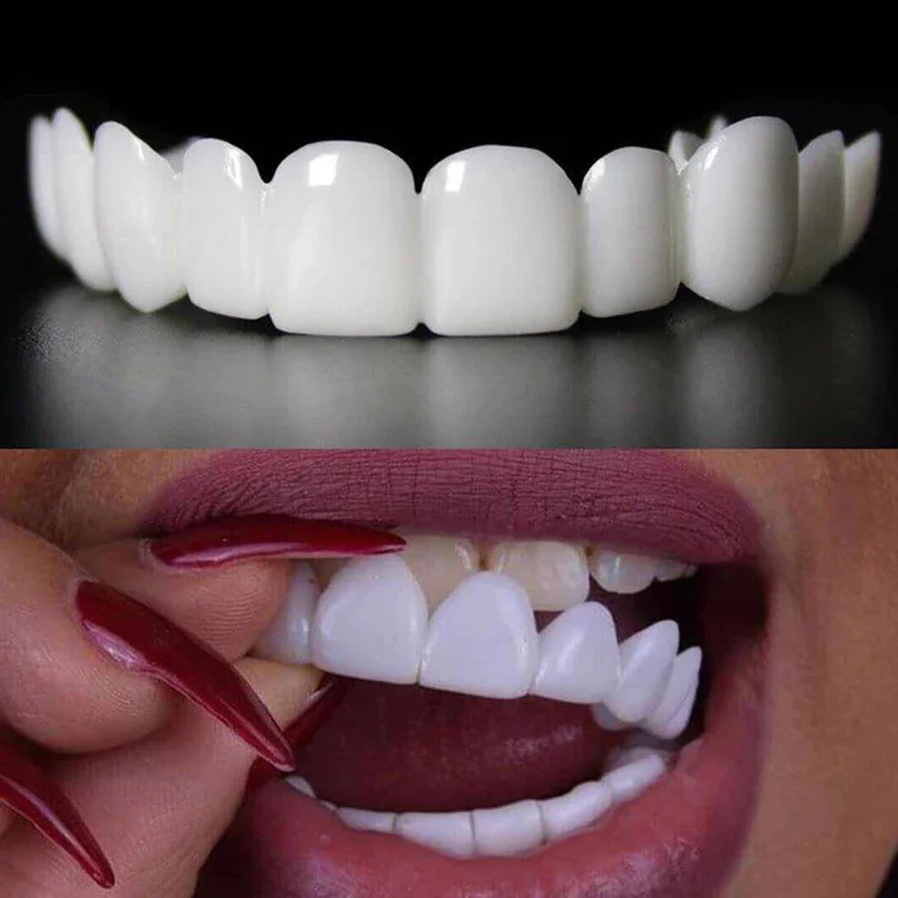 2Pcs/Set Comfort Fit White Teeth Cover Top Veneer Kit